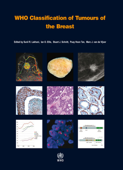 who classification of tumours of the breast 4e