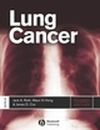 Wiley e-book - Lung Cancer