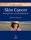 Wiley e-book - Skin Cancer